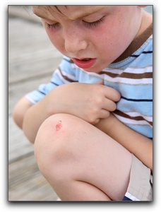 Treating Punta Gorda Kids' Minor Cuts And Bumps