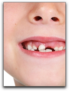 Oral Rinses For Healthy Children's Teeth In Port Charlotte